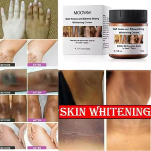 Private Label per la cura del viso intenso sbiancamento <span class=keywords><strong>Crema</strong></span> Blanqueadora rimozione rapida Acne <span class=keywords><strong>Crema</strong></span> idratante sbiancante per il corpo - Product Image 4