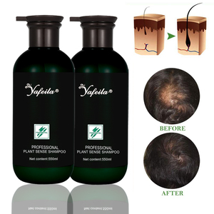 Shampoo contre la perte de cheveux, prix d'usine en marque privée, avec <span class=keywords><strong>un</strong></span> <span class=keywords><strong>bon</strong></span> effet, shampooing et revitalisant pour la croissance des cheveux à la menthe poivrée et au romarin - Product Image 3