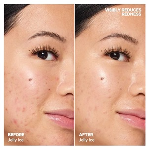Meilleure vente soins de la peau <span class=keywords><strong>Anti</strong></span>-rides hydratant éclaircissant le teint rétrécissement des Pores multi-effet visage Essence bâton - Product Image 6