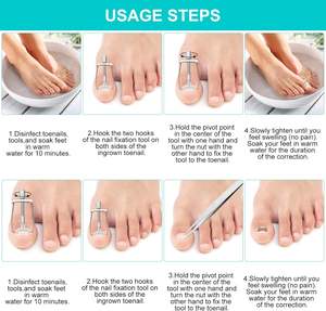 Kit de Correction des Ongles Incarnés, Ensemble de Soins des Pieds, <span class=keywords><strong>Pince</strong></span> à Ongles Courbée en Acier Inoxydable, <span class=keywords><strong>Traitement</strong></span> des Paronychies, Écologique et Esthétique - Product Image 4