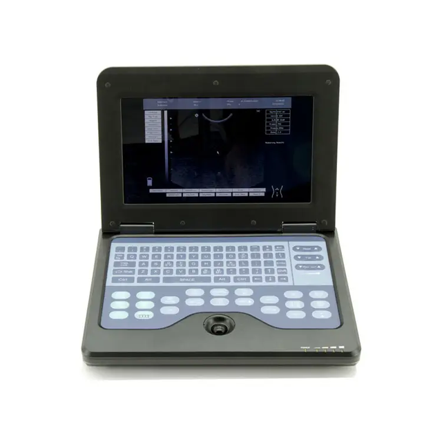 CONTEC CMS600P2 Portable Notebook Ultrasound Diagnostic System Microconvex Probe Medical Ultrasound Instruments Scanner