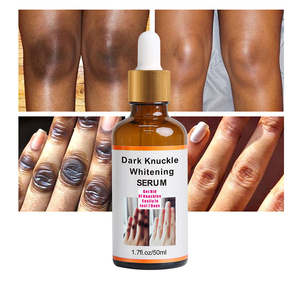 Suero Aclarante Rápido para Manos, Codos y Rodillas, Corrector de Pigmentación para Piel Oscura, Eliminador de Manchas Intensas - Product Image 3