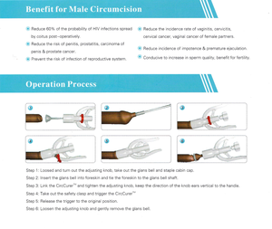 <strong>Disposable</strong> Medical <strong>Circumcision</strong> Stapler Device <strong>Kit</strong> for Adults and Children - Product Image 5