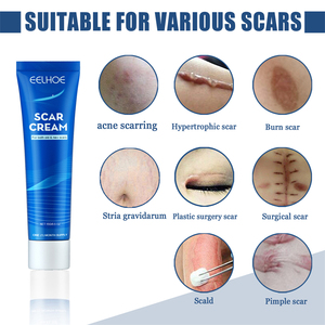 OEM Meilleure crème <span class=keywords><strong>pour</strong></span> l'élimination des cicatrices de brûlures d'acné Stria Gravidarum Chirurgical Pimple New Old Scar Removal Cream <span class=keywords><strong>pour</strong></span> enlever les cicatrices - Product Image 2