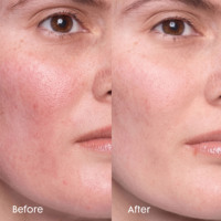 Crème hydratante pour le visage OAKAURA Ceramide Moisture Barrier 50ml, hydratation légère, adoucissante, pour peaux irrégulières, soin quotidien de la peau, OEM