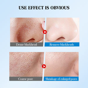 Masque facial peel-off éclaircissant She Milk Plus, nettoyage en profondeur, élimination des points noirs, hydratant, soin de la peau du visage, 20 g x 10 pièces - Product Image 6