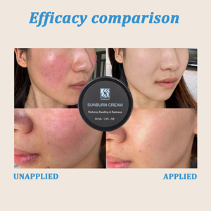 Logo personalizzato <span class=keywords><strong>crema</strong></span> <span class=keywords><strong>per</strong></span> scottature Calendula estratto di vitamina B & E dopo <span class=keywords><strong>crema</strong></span> <span class=keywords><strong>per</strong></span> la riparazione del <span class=keywords><strong>sole</strong></span> adatto a tutti i tipi di pelle - Product Image 6