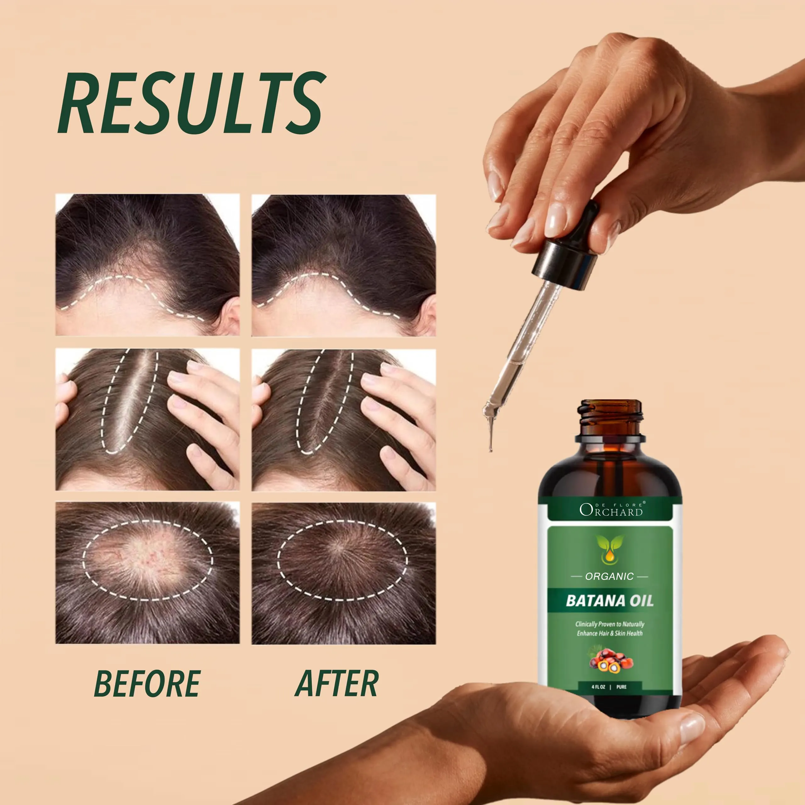 Wholesale Hair Treatment Nourishing   Moisturizing Pure Organic Batana Oil For Hair Growth