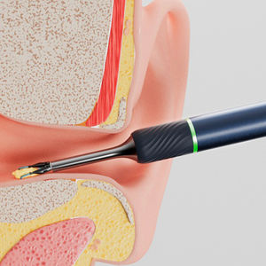 Bebird Note 5-endoscopio para inspección de la salud, limpiador al vacío de cera de los oídos, cámara para examen de los oídos - Product Image 5
