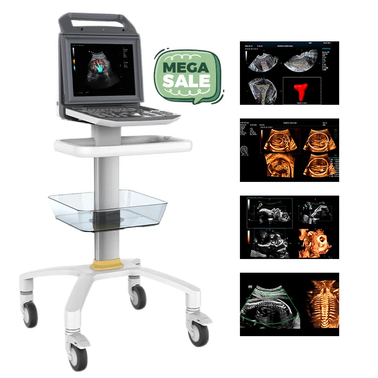 Moniteur LED 12.1 pouces 3D 4D Portable Couleur Doppler Machine à ultrasons numérique complète pour le diagnostic