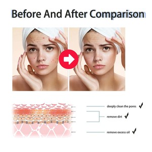 Sérum Facial Exfoliant Doux Hydratant et Anti-rides à 2% d'Acide Salicylique Liquide BHA et Glycérine – Nouvelle Vente Chaude en Gros - Product Image 6