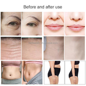 Feier a 7D 2 in1 High Intensity Focused Anti aged Face Lifting Straffung falten Entfernen Sie 7 Patronen 20000 Aufnahmen - Product Image 4
