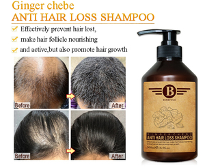 Set di <span class=keywords><strong>Shampoo</strong></span> Anti pidocchi per ispessimento e crescita con ingredienti di zenzero e bambù crema Formula 2-in-1 per adulti-Private Label - Product Image 3