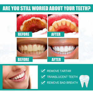 ผงขจัดคราบฟันธรรมชาติทำความสะอาดช่องปากผลิตภัณฑ์ความงามผงกำจัดฟันที่มีประสิทธิภาพทำให้ฟันขาวขึ้น - Product Image 3