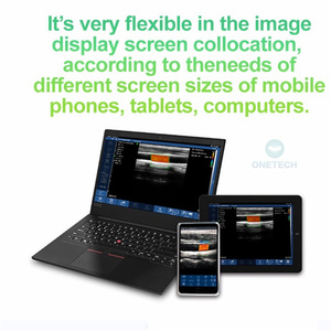 Échographe <span class=keywords><strong>portable</strong></span> sans fil C37G Clinic à haute fréquence pour l'analyse des couches et structures du visage, scanner d'imagerie couleur pour interventions esthétiques - Product Image 2