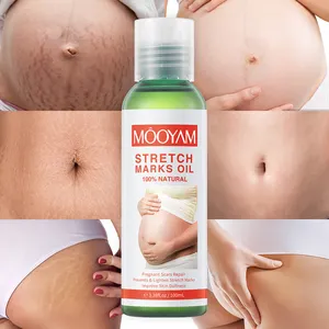 プライベートラベル妊娠おなか臀部腹部ニキビ跡、脂肪成長ストリークラインリムーバー、ストレッチマークオイルの7日間の修復