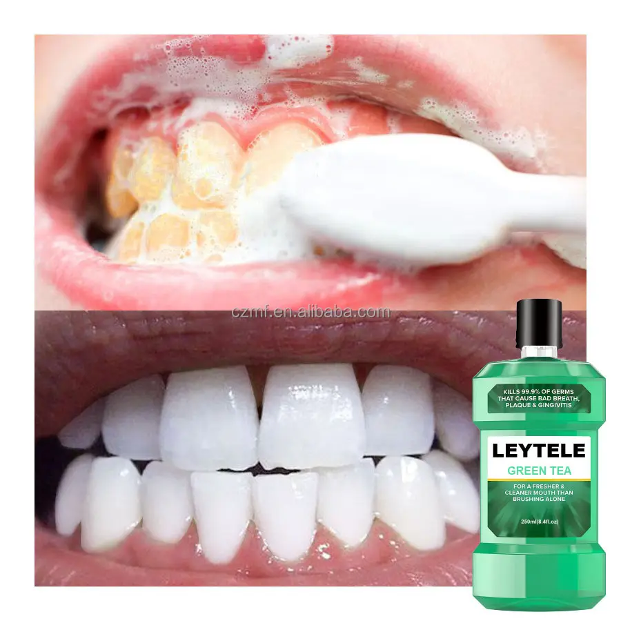 Nhãn Hiệu Riêng 250ML Hữu Cơ Tự Nhiên Răng Làm Trắng Chăm Sóc Răng Miệng Làm Sạch Răng Của Bạn Trà Xanh Súc Miệng