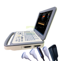 Promotion : Sonographe Doppler Portable pour Animaux – Échographe USG pour Bétail et Animaux de Compagnie avec Sonde d'Examen