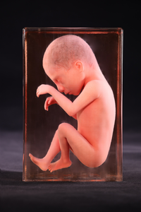 Modèle d'embryon 3D, outils d'enseignement de l'<span class=keywords><strong>embryologie</strong></span>, éducation médicale moderne, sciences médicales - Product Image 4