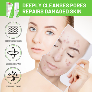 Vendita all'ingrosso Disaar acido salicilico & Ceramide siero per la cura del <span class=keywords><strong>viso</strong></span> Acne siero con radice di liquirizia <span class=keywords><strong>antibatterico</strong></span> liscia il siero della pelle - Product Image 6