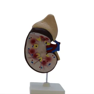 Hot Products Biomedical Teaching Instrument Human Tissue Model Kidney Anatomy Model