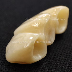 Couronnes en zircone solide avec <span class=keywords><strong>porcelaine</strong></span> Built-up Full Service China Dental Lab <span class=keywords><strong>Prix</strong></span> - Product Image 6