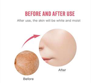 QBEKA Crema Facial Blanqueadora para Eliminar Pecas, Antienvejecimiento, Antiarrugas, Hidratante, Cuidado Facial, Elimina Pecas y Acné - Product Image 6