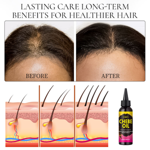 Tratamiento para la Caída del Cabello Luxfume, Aceite de Chebe 100% Natural, Promueve el Crecimiento del Cabello, Aceite Nutritivo para el Cuero Cabelludo, Alivia la <span class=keywords><strong>Caspa</strong></span> - Product Image 3