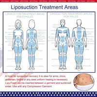 Lipo-Schaumstoffplatte für Lendenkissen, Sitzkissen, Liposuktions-Taillenstütze, Schaumstoffplatte für Bauchmuskeltrainer und Kompressionsanzüge