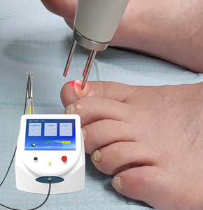 <span class=keywords><strong>Tratamiento</strong></span> Portátil para Hongos en las Uñas con Láser de Diodo de 980nm, Eliminación de Hongos en los Dedos, Verrugas <span class=keywords><strong>Plantares</strong></span>, Podología, Eliminación de Venas, Onicomicosis - Product Image 1