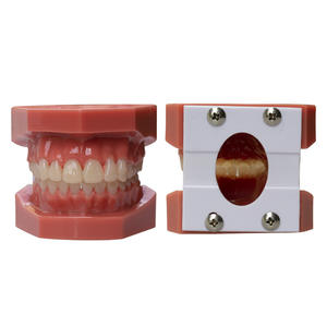 Modèles de démonstration de malocclusion dentaire en PVC pour la pratique orthodontique, moules d'enseignement avec attaches de brackets - Product Image 3