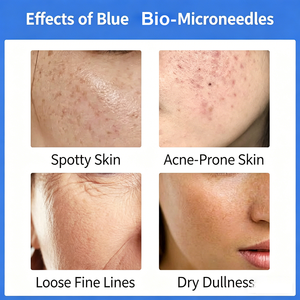 Sérum professionnel bio-microneedling anti-acné et anti-pigmentation à base d'éponge d'algues Spongilla Spicule pour le <span class=keywords><strong>visage</strong></span>, marque privée - Product Image 3