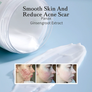 Crema Blanca para Eliminar Cicatrices de Embarazo, Estrías y Acné, Ingredientes Herbales 100% Naturales, Antiarrugas, 50g - Product Image 3