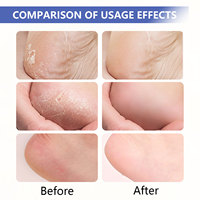 Crème pour la peau au beurre de karité naturel, à l'acide salicylique et à l'urée, crème réparatrice des cicatrices cutanées, crème nourrissante pour les peaux sèches, pour les mains et les pieds