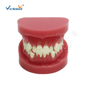 Modèle d'alignement dentaire défaillant, modèle dentaire, modèle pédagogique pour la pratique orale dentaire - Product Image 5
