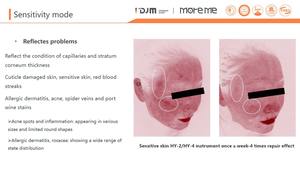 DJM 2024 Moreme 14-em-1 AI Skin Analyzer Scanner Facial Portátil com Câmera Integrada - Product Image 5