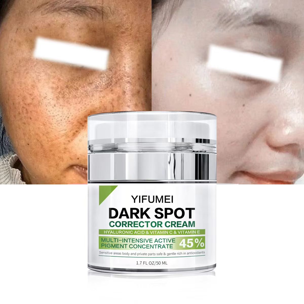 Dark spot cream
