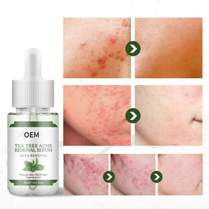 Sérum de soin de la peau de marque privée arbre à thé traitement de l'acné sérum <span class=keywords><strong>pour</strong></span> le visage réparation des boutons avec élimination des points noirs propriétés hydratantes - Product Image 1