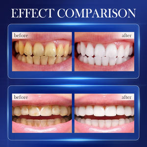 OEM SADOER Etiqueta Privada menta cuidado bucal productos de limpieza bicarbonato de sodio eliminar el mal aliento limpiar sarro blanquear los dientes pasta de dientes - Product Image 3