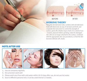 Machine de microdermabrasion <span class=keywords><strong>Jet</strong></span> d'oxygène lueur <span class=keywords><strong>diamant</strong></span> Dermabrasion outils de soins de la peau poudre sous vide en cristal pour le nettoyage du visage - Product Image 3