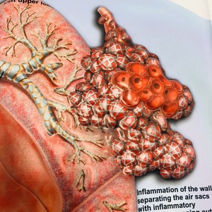 Lo studente umano i polmoni che insegna <span class=keywords><strong>3D</strong></span> Poster medico personalizzato Poster murale - Product Image 3