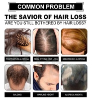 Meilleure huile de croissance des cheveux pour la calvitie Réparation du cuir chevelu Huile capillaire Anti perte de cheveux