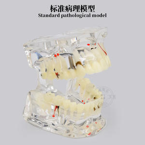Modelo Dental de Ortodoncia, Brackets Semi-Cerámicos Semi-Metálicos, Implante de Plástico, Prótesis para la Comunicación Médico-Paciente y la Enseñanza - Product Image 5