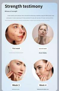 Newly Released 3D Facial Silicone Household Skin Care Whitening Acne <b>Wrinkle</b>-<b>Removing</b> Flexible - Product Image 4