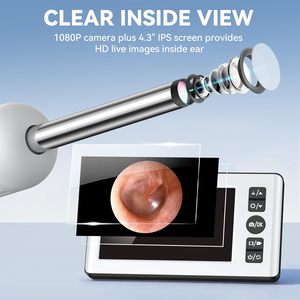 Professional Visual <b>Ear</b> <b>Cleaning</b> Device with HD Screen <b>Ear</b> Wax Removal <b>Tool</b> for Salon Use - Product Image 2