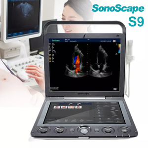 Sonoscape S9 équipement d'imagerie médicale portable machine à ultrasons mobile guide d'aiguille <span class=keywords><strong>échographie</strong></span> cardiaque 4d - Product Image 3