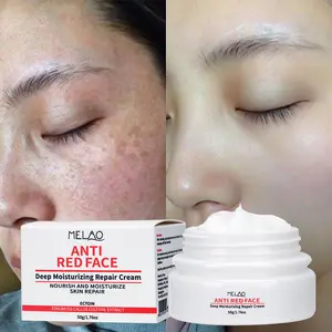 Skincare Routine Anti Redness Concealing Day And Night Cream Calming Repair Cream For Redness Relieving