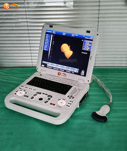 Diskon besar medis B/W Ultrasound 3D untuk gyne dan mesin obs untuk kehamilan - Product Image 3