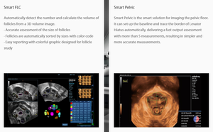 Mindray DC70 con Certificación CE, Gran Oferta, Sistema de Escáner de Diagnóstico por Ultrasonido Médico <span class=keywords><strong>5D</strong></span>, 3D, 4D con Doppler Color - Product Image 6