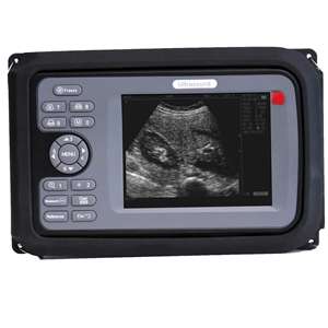 Handscan Scanner de mao appareil à ultrasons portable bon marché pour vétérinaire - Product Image 1